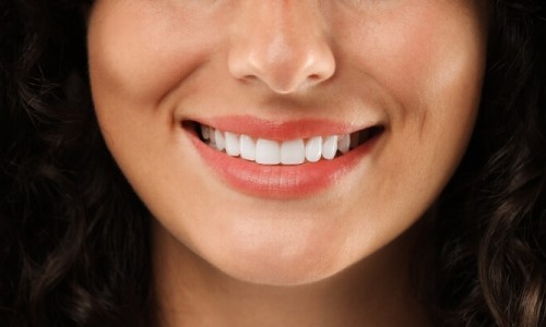 Bayrampaşa Gülüş Tasarımı