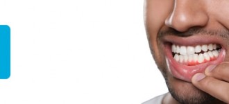 clinic 500 diş eti hastalıkları