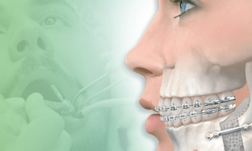 Kartaltepe Uzman Çene Cerrahı