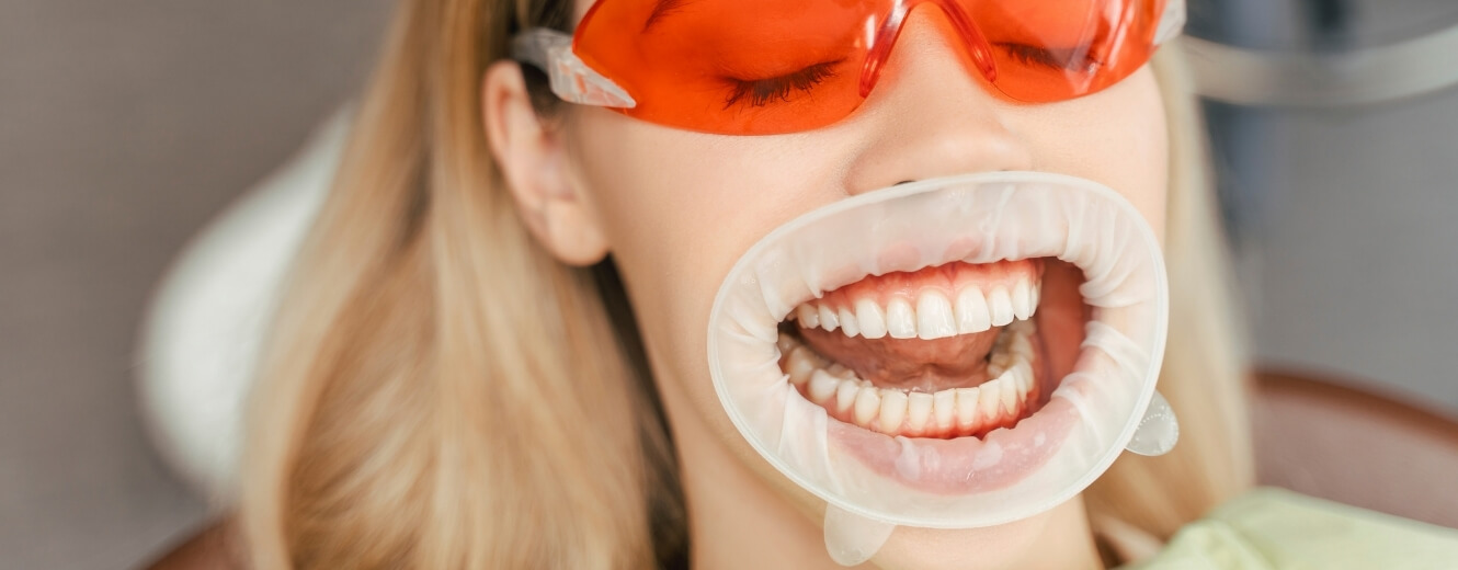 Küçükköy Diş Beyazlatma