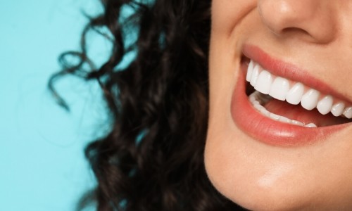 Beşyüzevler Gülüş Tasarımı