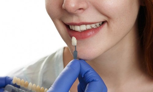 Zirkonyum Kaplama Sonrası Nelere Dikkat Edilmeli?